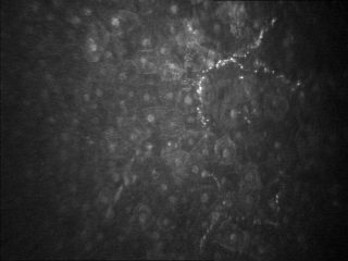 Картина поверхностного эпителия нормальной роговицы по данным конфокальной микроскопии